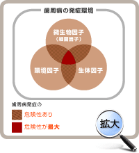 歯周病の3つの因子