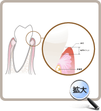 初期歯周治療終了後