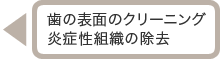 歯の表面のクリーニング 炎症性組織の除去